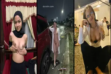video full komplikasi Kayla viral
